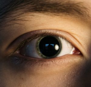 How to Use Honey to Help Your Eyes
